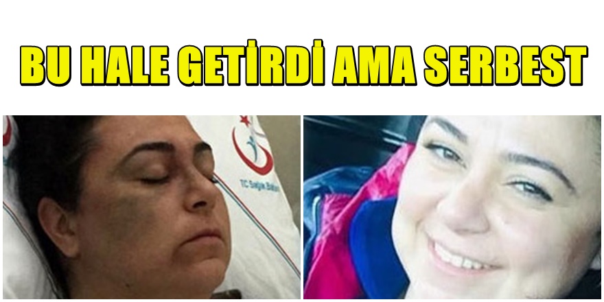 Antalya'da 3 kadına saldıran maganda serbest bırakıldı