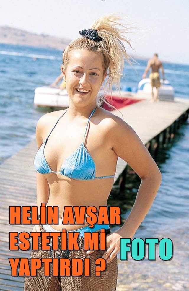 Helin Avşar Estetik mi yaptırdı