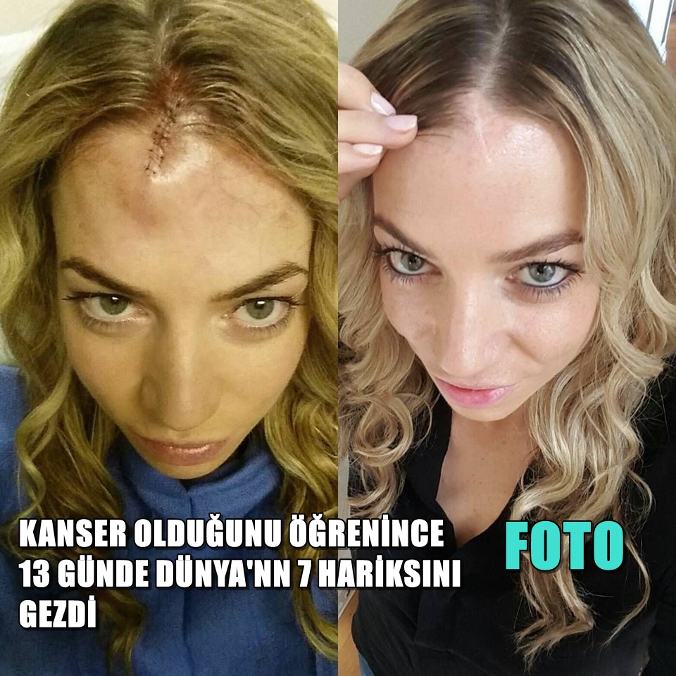 Kanser oldu gezginliğe soyundu