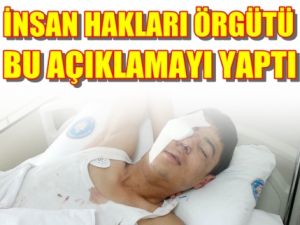 İnsan Hakları Örgütünden Zehir Zemberek Açıklama