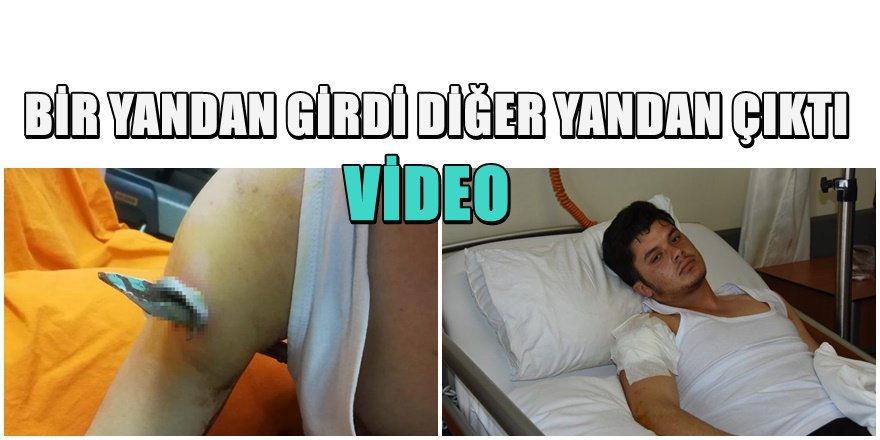 ÜRPERTEN GÖRÜNTÜ  Samsun'da Korkuluk Faciası