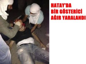 Hatay'da Bir Gösterici Ağır Yaralandı