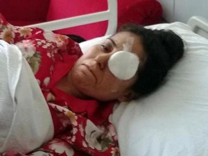 PLASTİK MERMİ KÖR ETTİ İDDİASI