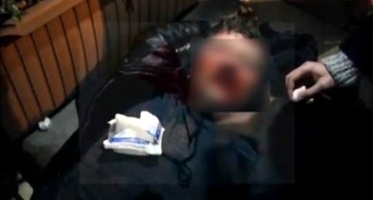 İŞTE ORANTISIZ POLİS ŞİDDETİ