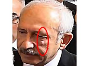 KILIÇDAROĞLU'NA SALDIRIDA FLAŞ GELİŞME