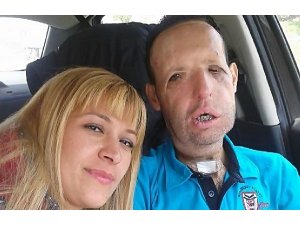 YÜZ NAKLİ OLAN RECEP SERT NİŞANLANDI