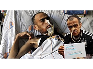 BİBER GAZI YÜZÜNDEN ÖLMEK ÜZERE