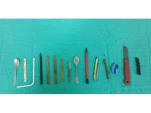 MİDESİNDEN 16 PARÇA YABANCI CİSİM ÇIKTI