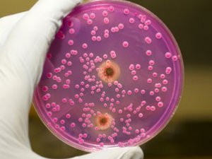 TÜM HASTALIKLARIN SEBEBİ O OLABİLİR!