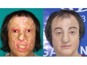 TÜRK DOKTORUN İNANILMAZ BAŞARISI