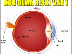 Üniversiteden Şok Göz Uyarısı !