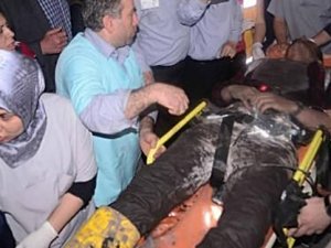 EN ACI TEŞHİS EN ACI ANONS