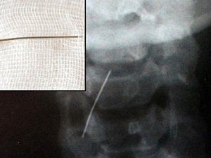 BAŞÖRTÜSÜ KULLANANLAR DİKKAT