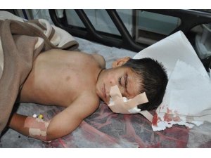 CİZRE'DE EVİNDE OTURAN ÇOCUK BAŞINDAN YARALANDI