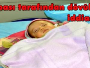 7 aylık bebek babası tarafından dövüldü iddiası
