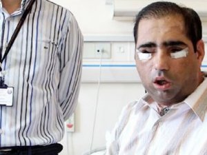 ANTALYA'DAN KÖTÜ HABER GELDİ