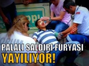 Palalı Saldırı Furyası Yayılıyor!
