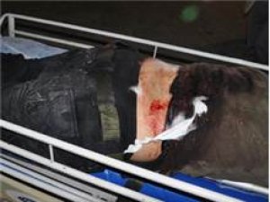 SINIRDA PATLAMA: ÇOK SAYIDA ÖLÜ VE YARALI VAR