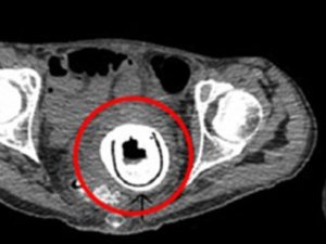 MUCİZE VİBRATÖR AÇIK ARTIRMAYA ÇIKACAK!