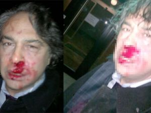 BARBAROS ŞANSAL'A SALDIRI ANI KAMERADA!