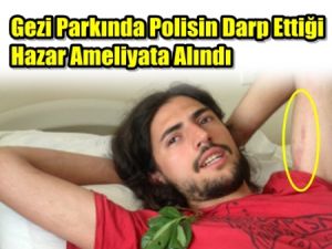 Taksim Gezi parkında Yaralanan Genç BBC'ye Konuştu
