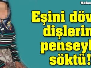 Eşini dövdü, dişlerini penseyle söktü