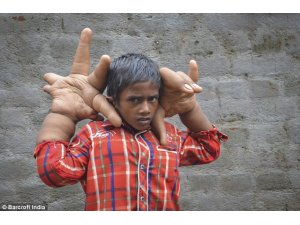 DEV ELLİ ÇOCUĞUN İNANILMAZ DRAMI