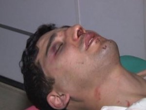 DÖVÜLEN F 16 PİLOTU OLAYINDA FLAŞ GELİŞME