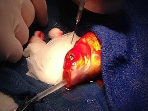 80 GRAMLIK BALIK TÜMÖR AMELİYATI OLDU