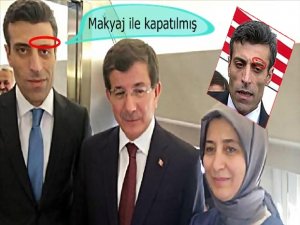 REHİNELERİN KONUŞMALARI NEDEN YASAKLANDI