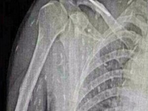 Suşi sevenler bu haberi okusun