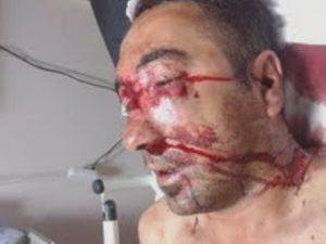 Kim Çapulcu Fotoğraflara bakın siz karar verin +18