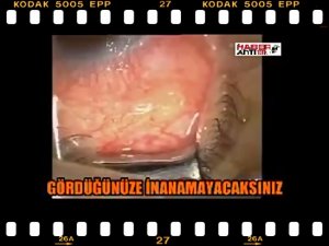 GÖZÜN İÇİNDEN ÇIKANA İNANAMAYACAKSINIZ