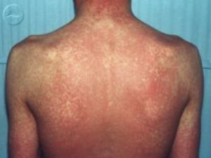 Tabipler Odası: "TOMA'dan Sıkılan Suyun İçinde Ne Var?"