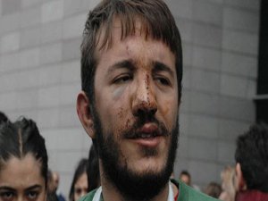 ALİ İSMAİL'İ DÖVEN POLİSE BİR VAHŞET İDDİASI DAHA