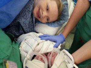 İKİ BAŞLI BEBEK DOĞDU