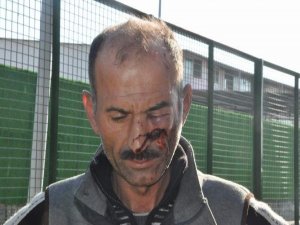 PAVYONDA HESABA İTİRAZ EDİNCE AĞZINI BURNUNU KIRDILAR