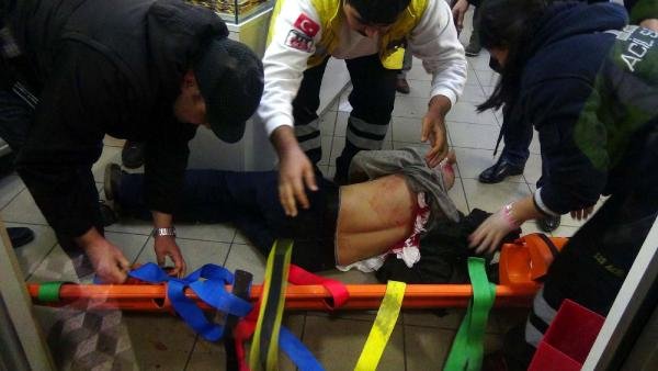 YENGESİNİ DÖVDÜ ERKEK ARKADAŞINI MAKASLA AĞIR YARALADI