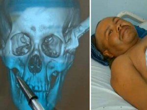 BAŞINA SAPLI BIÇAKLA İKİ SAAT OTOMOBİL KULLANDI