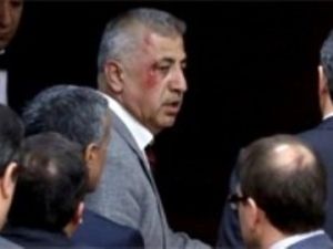 Meclis’te kanlı kavga