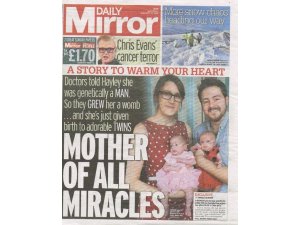İNGİLTERE'DE MUCİZE; ERKEK İKİZ BEBEK DOĞURDU
