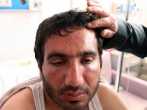 “Polis kafama basıp zıpladı“