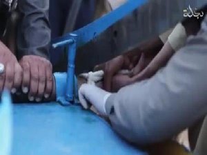 IŞİD HIRSIZ DİYE BİR ÇOCUĞUN ELİNİ KESTİ