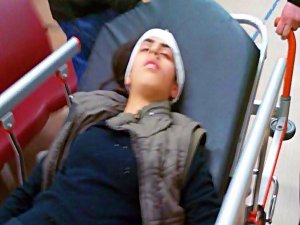 BİR ÇOCUK DAHA GAZ BOMBASI İLE AĞIR YARALANDI