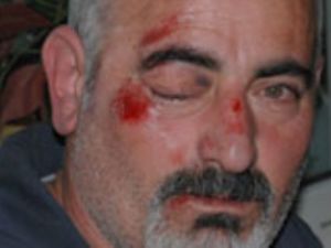 Mahkemede tanıklık yapan gazeteciyi hastanelik ettiler