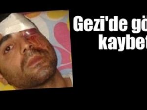 İşine gidiyordu, 5 metreden gaz fişeği ile vuruldu