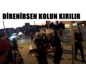 'Direnirsen Kolun Kırılır'
