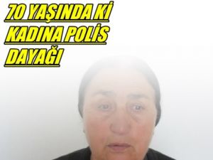 Polis 70 Yaşında ki Kadını Dövdü
