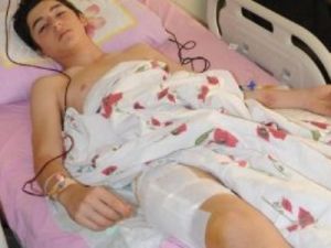 Polis Copuyla Kırılan Bacağa Soru Önergesi