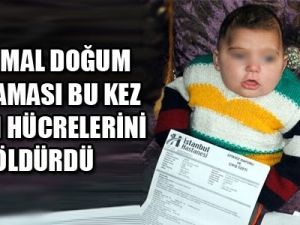 Normal doğum zorlaması bu kez bebeğin beyin hücrelerini öldürdü